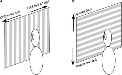 Treatment of Gravitational Pulling Sensation in Patients With Mal de Debarquement Syndrome (MdDS): A Model-Based Approach